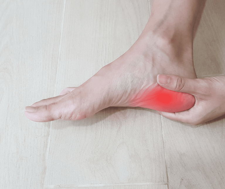 Planter Fasciitis